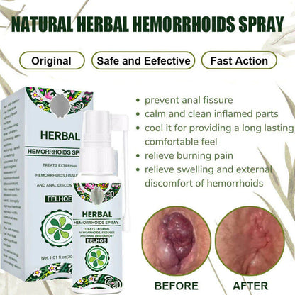 Hemorrhoid Relief Spray – Natural Herbal Soothing Treatment for Swelling, Itching & Discomfort Support