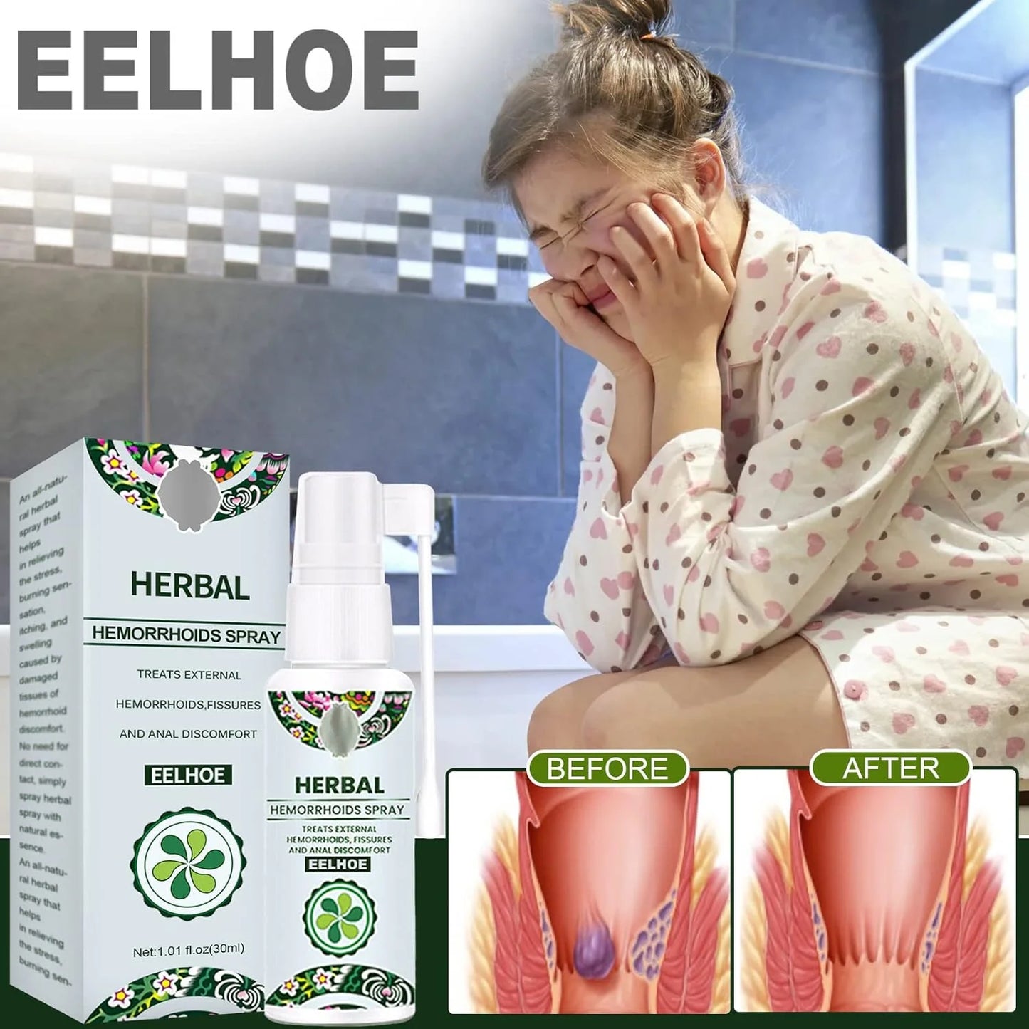 Hemorrhoid Relief Spray – Natural Herbal Soothing Treatment for Swelling, Itching & Discomfort Support